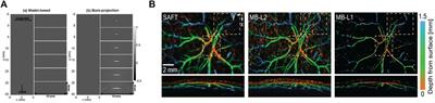 A practical guide for model-based reconstruction in optoacoustic imaging